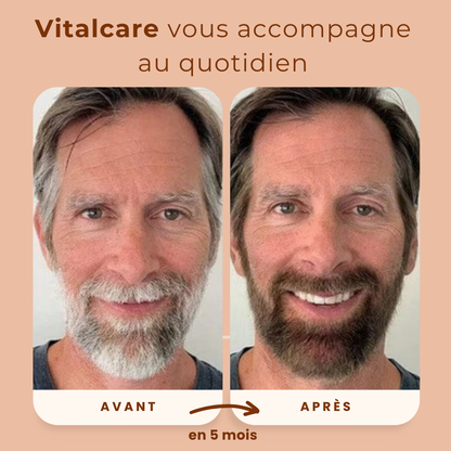 Sérum Anti-Cheveux Blancs (pack 2 flacons)